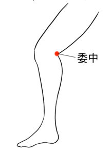 ぎっくり腰の鍼灸治療で用いるツボの図