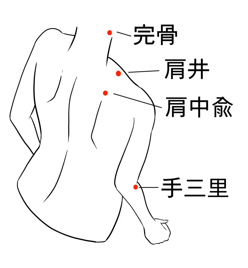 頚肩腕症候群の鍼灸治療で用いるツボの図