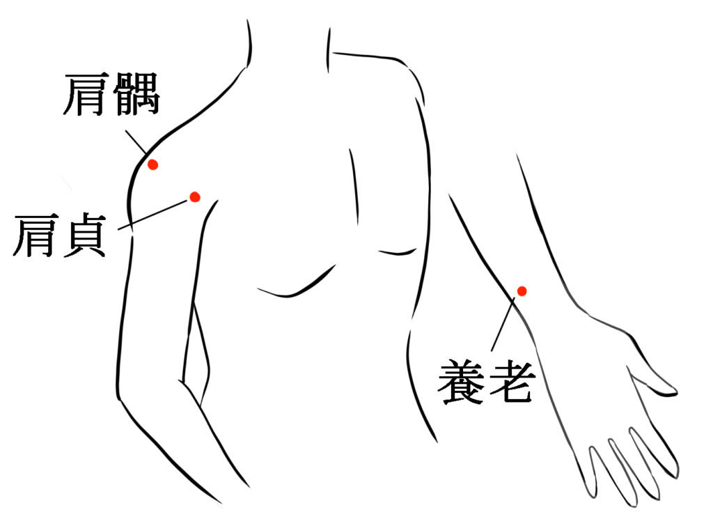 五十肩の鍼灸治療で使うツボの図