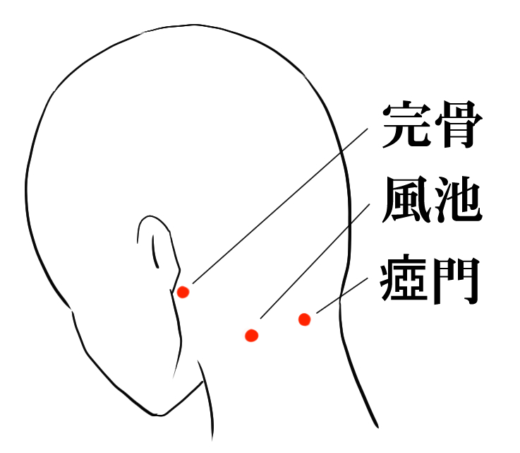 偏頭痛の鍼灸治療で使うツボの図