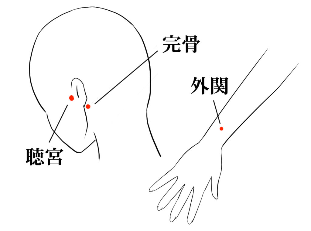 耳鳴りの鍼灸治療で使うツボの図