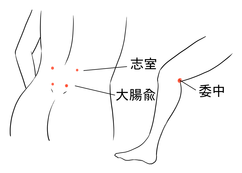 脊柱管狭窄症の鍼灸治療のツボの図